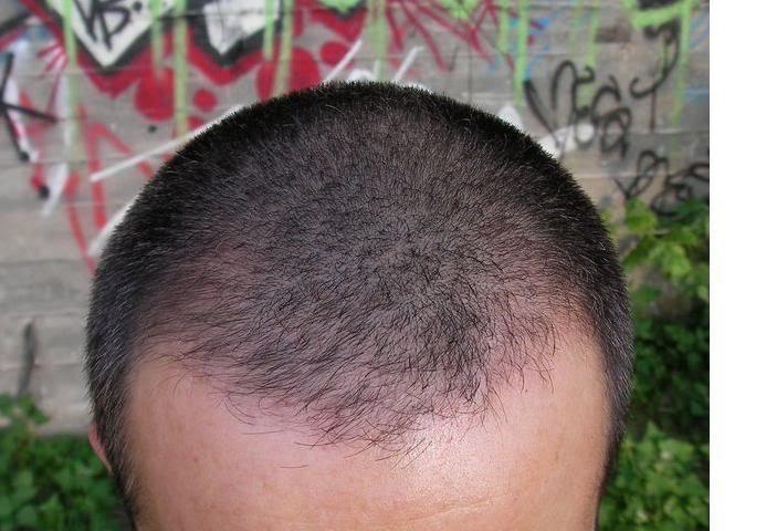 Real case photograph showing the later short-hair appearance